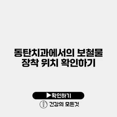 동탄치과에서의 보철물 장착 위치 확인하기